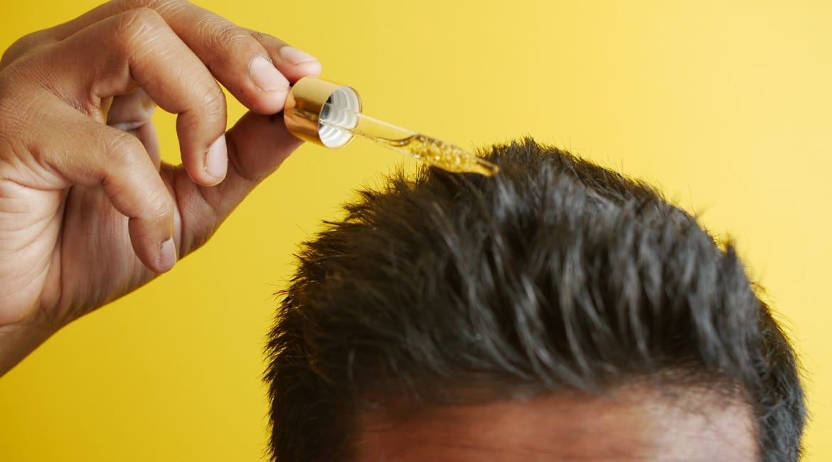 Minoxidil
